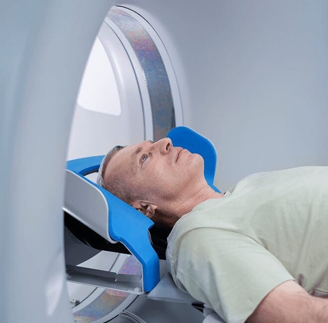 A person lies on their back inside an MRI machine with a blue headrest, looking upwards.